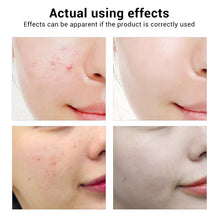Load image into Gallery viewer, Tea  Tree Essence Acne Treatment Serum

